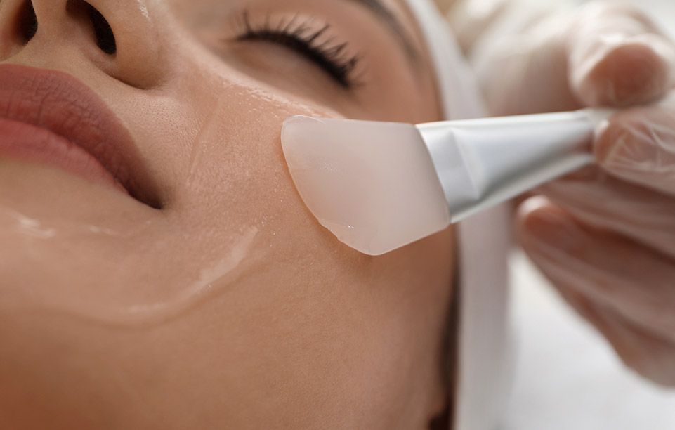 Medical-grade chemical peel and skin treatment