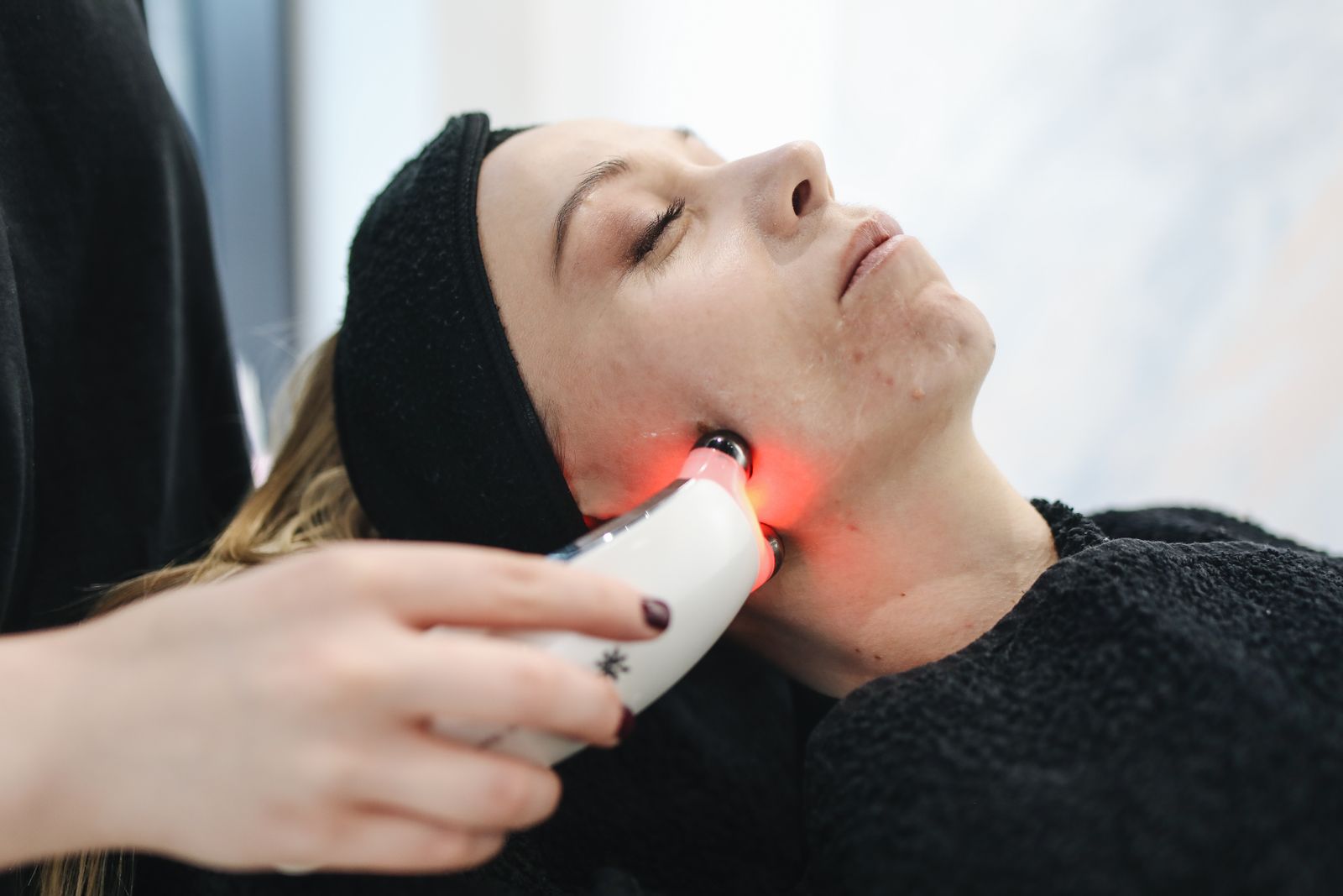 Fractional CO2 Laser at Natural Results in Scottsdale, AZ