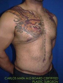 Case #17539 after right oblique