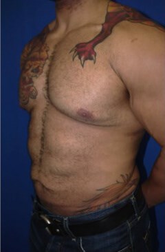 Case #17539 before left oblique