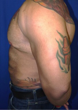 Case #17539 before left