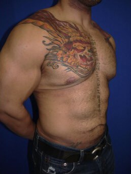 Case #17539 before right oblique