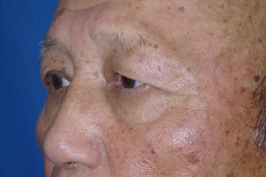 Case #17667 before left oblique