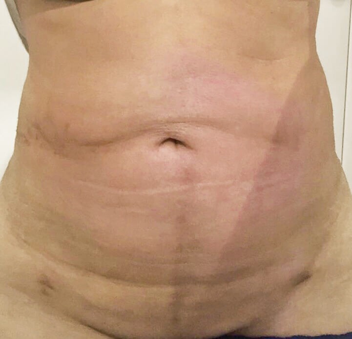 Case #31580 After