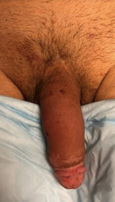 Case #41117 after opt