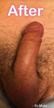 Case #41122 after