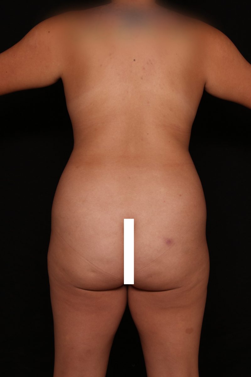 Case 78 -6