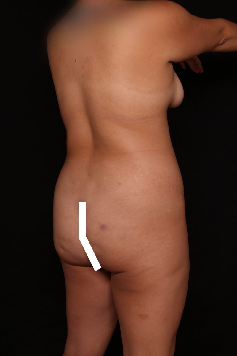 Case 78 -7